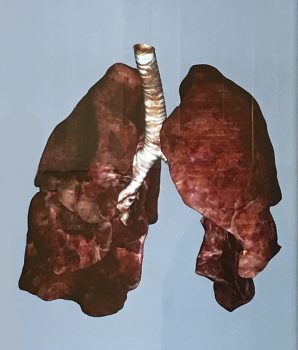 Biomedical Science Tool Jumpstarts Anatomical Examinations - Academics Keiser University Biomedical Science students are enjoying the opportunity to gain additional insights into anatomy thanks to a three-dimensional tool
