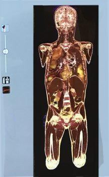 Biomedical Science Tool Jumpstarts Anatomical Examinations - Academics Keiser University Biomedical Science students are enjoying the opportunity to gain additional insights into anatomy thanks to a three-dimensional tool